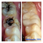 cometic-fillings-02-400x400-1.jpg