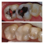 cometic-fillings-03-400x400-1.jpg