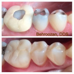 cometic-fillings-05-400x400-1.jpg