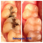 cometic-fillings-06-400x400-1.jpg