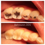 cometic-fillings-07-400x400-1.jpg