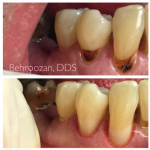 cometic-fillings-08-400x400-1.jpg