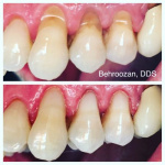 cometic-fillings-09-400x400-1.jpg