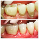 cometic-fillings-11-400x400-1.jpg