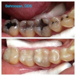 cometic-fillings-12-400x400-1.jpg
