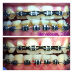 ultrasonic-cleaning-01-400x400-1.jpg