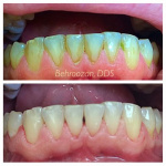ultrasonic-cleaning-07-400x400-1.jpg